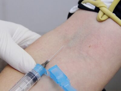 Punção venosa: agulha aplicada no braço de uma paciente por profissional de saúde com luvas